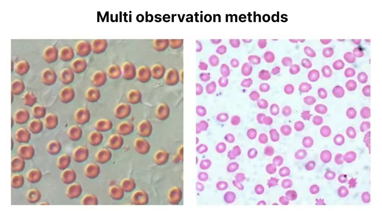 Inverted Fluorescence Microscope Phase Contrast