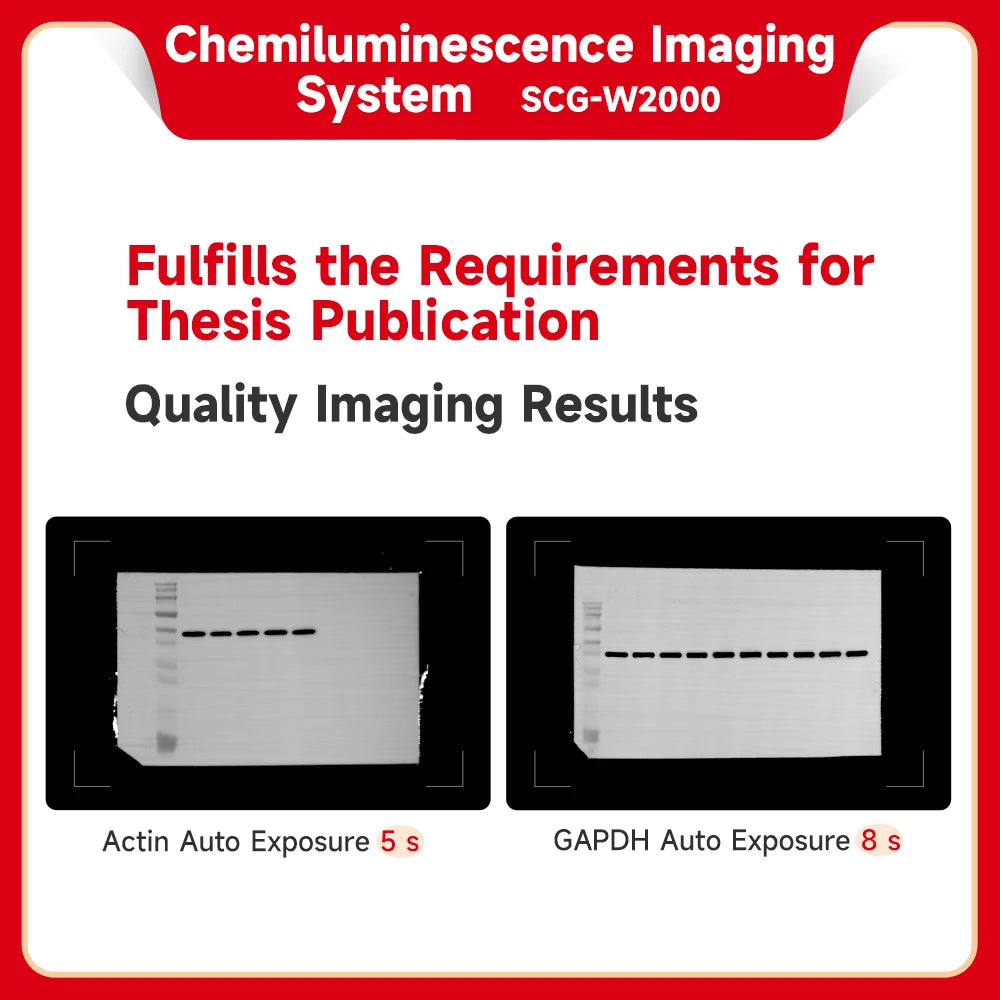 Ultrasensitive Gel Imaging System, Automatic Chemiluminescence Imager, Western Blot Imaging Machine