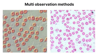 Inverted Fluorescence Microscope Phase Contrast
